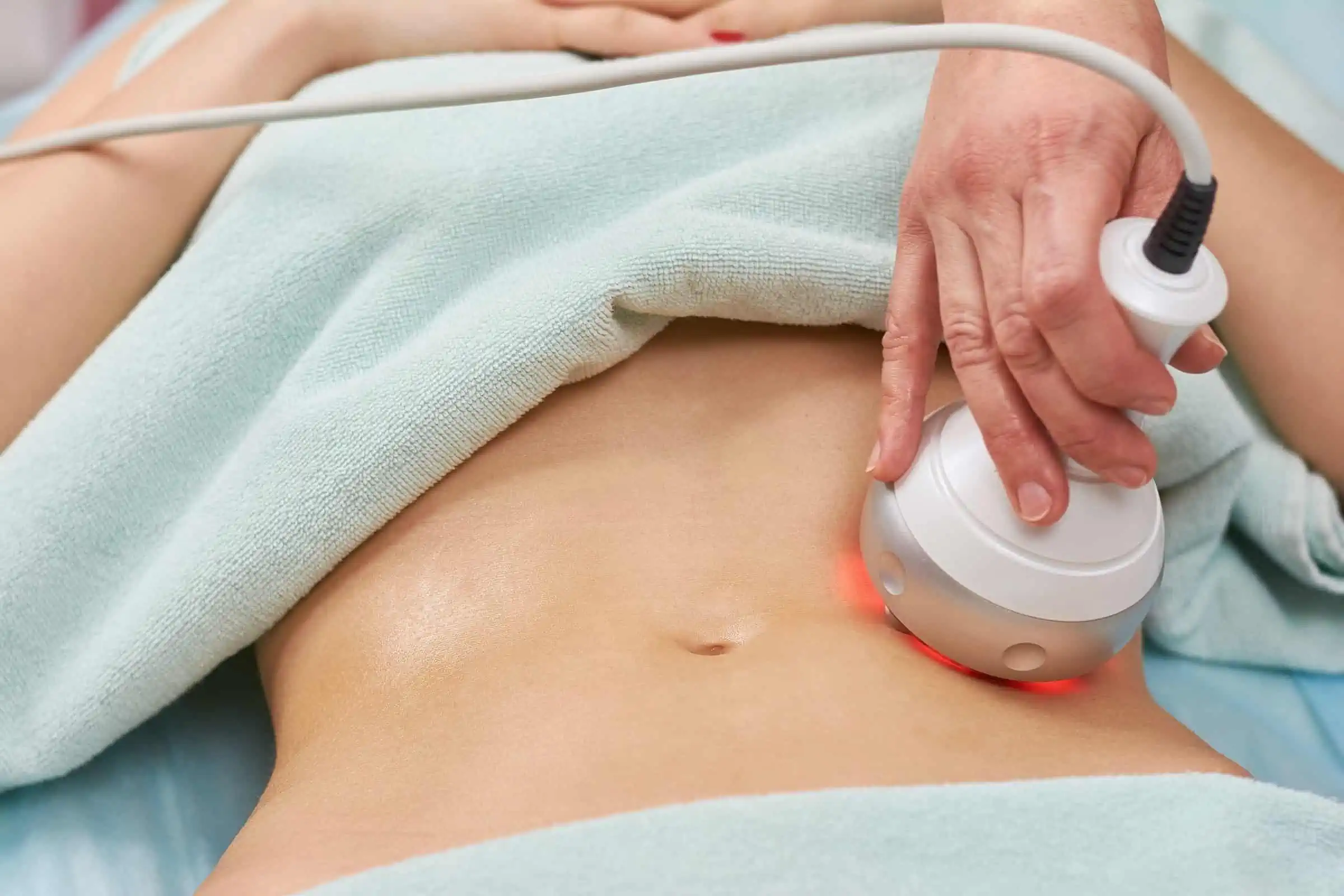 RF Body Sculpting