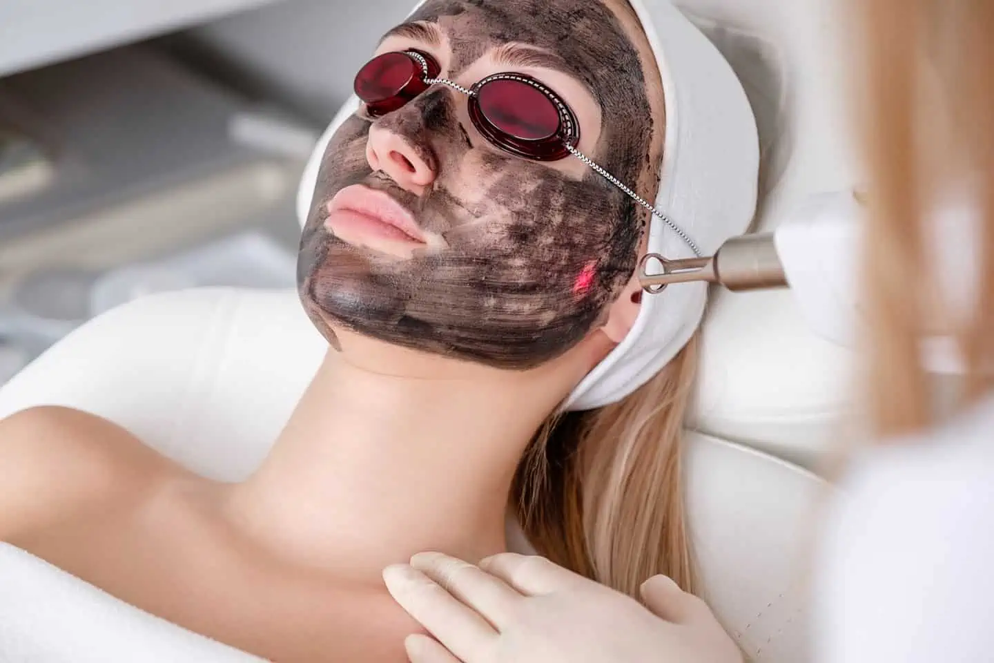 Carbon Laser Facial Services | Samara Medspa