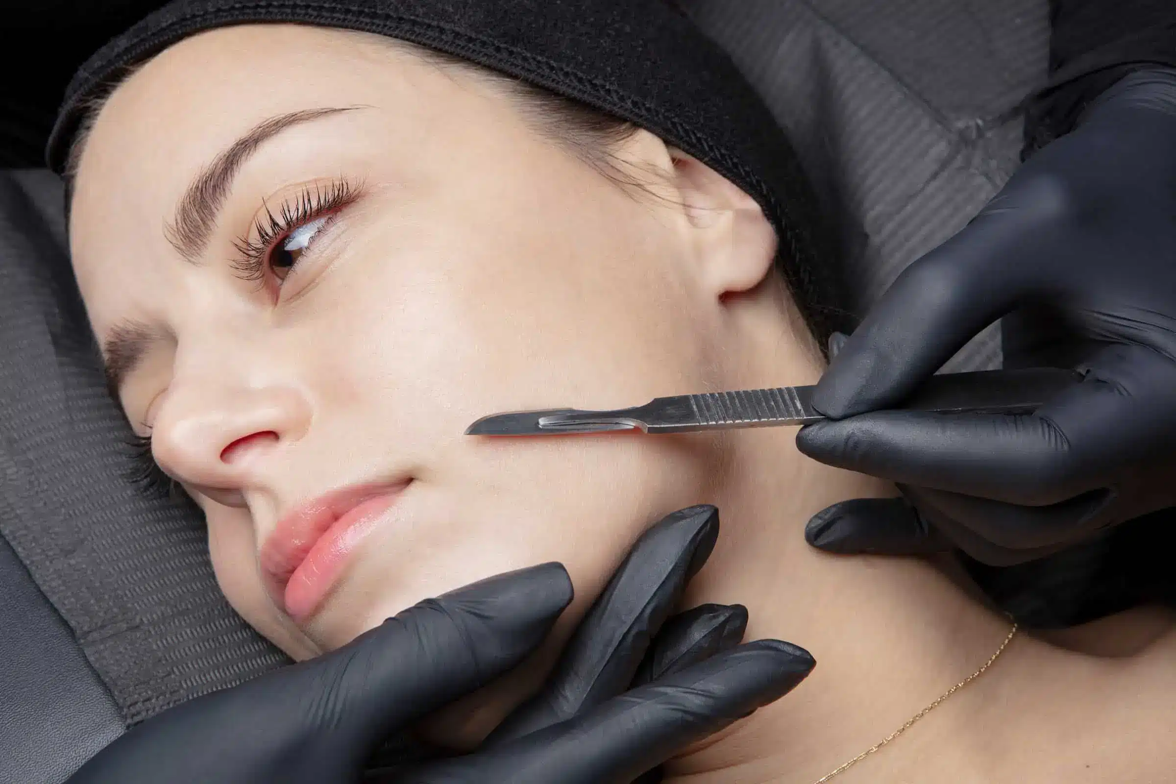 a woman receiving a dermplanning procedure