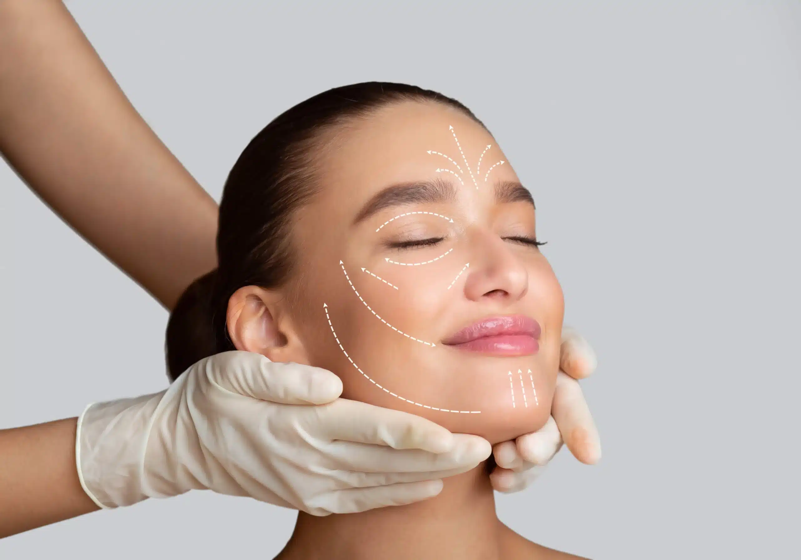PRF Tear Trough Treatment in Avon